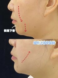 -Yestar重庆艺星医疗美容医院