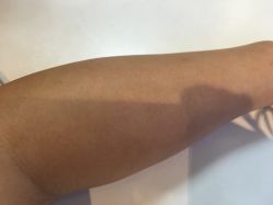 -净妍美肌专业净毛嫩肤连锁机构