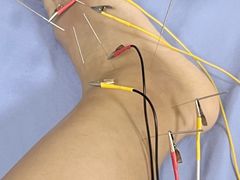 -广州中医药大学第三附属医院(骨伤科分院)