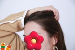 -大麦微针植发丨全国连锁