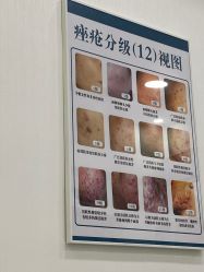 -荟草堂痘肌修护中心