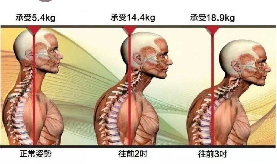 你知道自己的颈椎承受多大的压力吗?