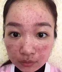 -E.beauty驻颜·痘敏肌调理中心