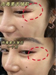 -厦门美莱整形美容医院