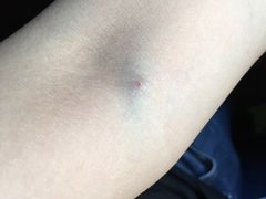 -上海市第八人民医院-体检中心