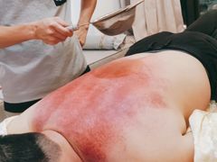 -张钰强中医正骨推拿连锁(华发商都店)