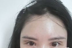 -洁铭新加坡医美