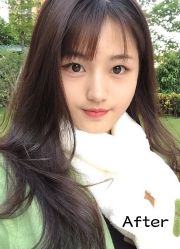 -小忠丽格医美