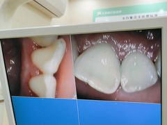 -大白象口腔连锁·矫正·种植中心(玺悦城店)