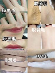 -薇兰专业脱毛连锁机构