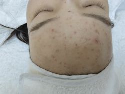 -痘院长·祛痘·科技美肤