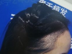 -雍禾植发全国连锁