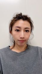 点击看大图 体验后-叶美人医疗美容