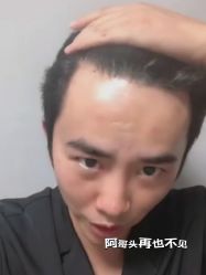 -雍禾植发全国连锁