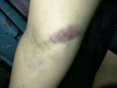 -北京中西医结合医院