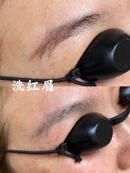 -德绣·机器野生眉发际线·美瞳线半永久