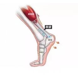 -香薇妮丝女子减肥院