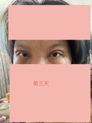 -天津伊美尔医疗整形美容专科医院