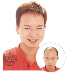 -发饰美男士增发补发假发定制店