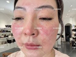 -SOS修丽可.痘肌修复中心