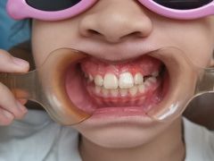 -齐玉齿科JADENTAL