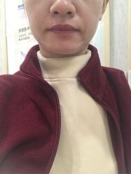 -广州健丽·去眼袋医疗美容机构