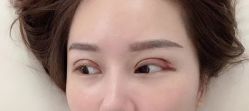 -广州美莱医疗美容医院