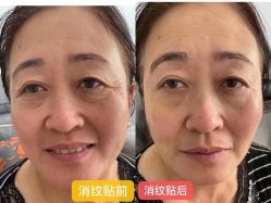 -凡碧诗毛孔收细