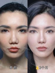 -深圳艺星医疗美容医院
