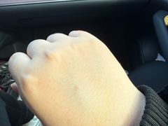 -上海市第八人民医院-体检中心