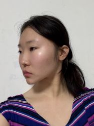 -四川米兰柏羽医学美容医院