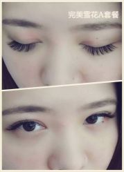 睫毛嫁接-光SPA科技美肤