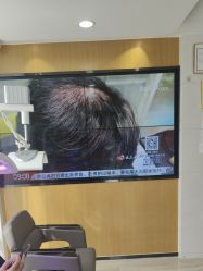 -雍禾植发全国连锁