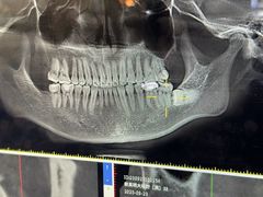 -哈尔滨圣安口腔专科医院