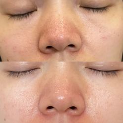 -尊尚柏丽美容SPA