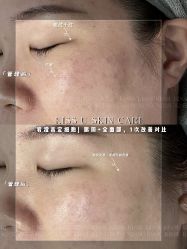 -KISS U 国际美学