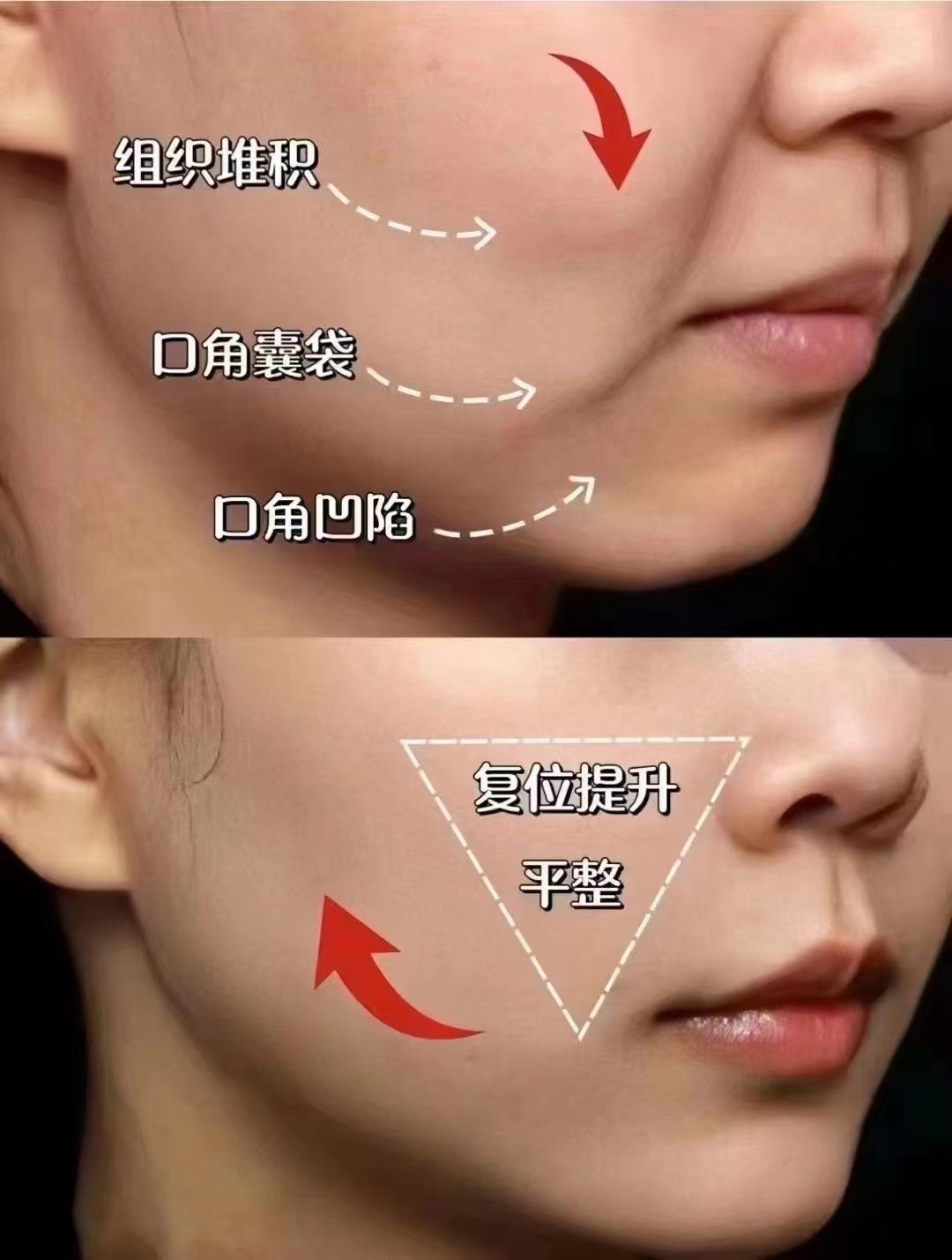 英诺小脂素77紧致素