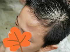 -龙达温泉生态城