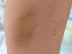 -华中科技大学同济医学院附属协和医院(主院区)