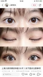 -脸博士医疗美容·眼鼻整形·抗衰中心