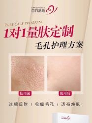 -苗方清颜专业祛痘连锁机构
