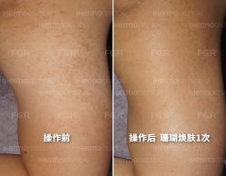 -苗方清颜痘肌研究所