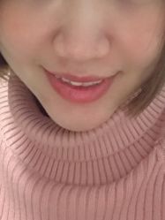 体验后-JS医疗美容