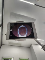 -凡碧诗毛孔清洁收细