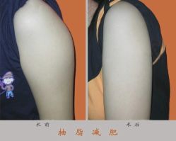 -广州美莱医疗美容医院