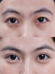 点击看大图 -Yestar重庆艺星医疗美容医院