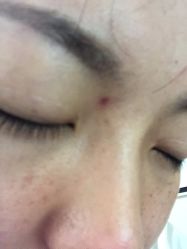 -坤如玛丽·医疗美容中心