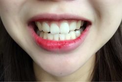 -美莱医学美容医院