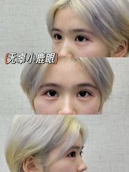 -深圳艺星医疗美容医院
