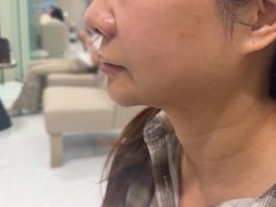 -Yestar艺星整形美容医院
